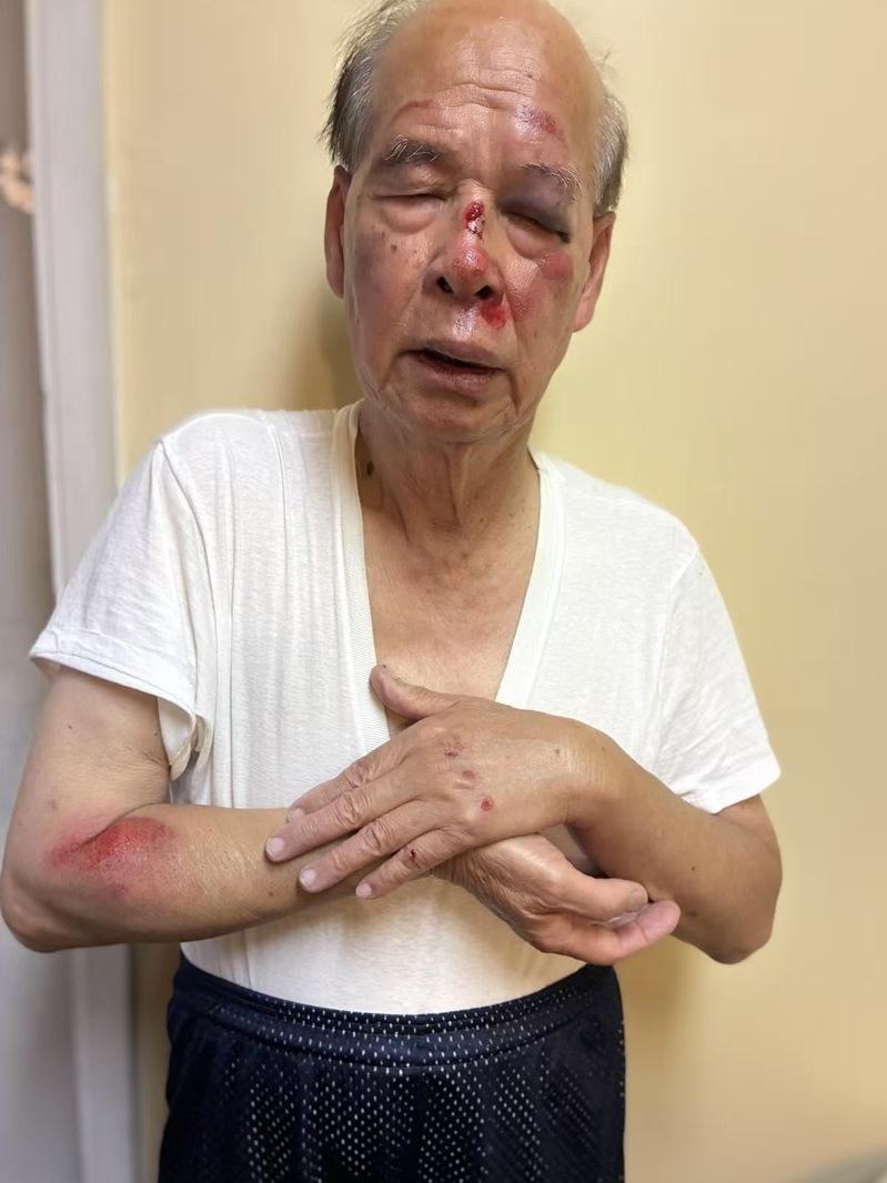 93岁知名侨领 超市外遭劫匪残忍拖行
