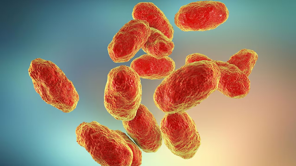 卡尔加里出现罕见感染病例，医院发出警告