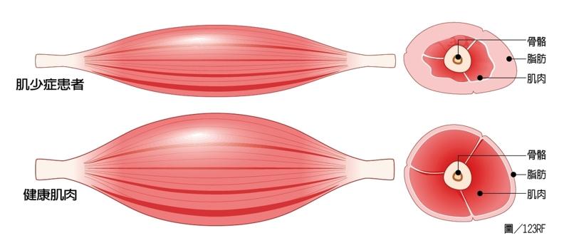 封面故事／研究：肌肉衰退比你想像的早